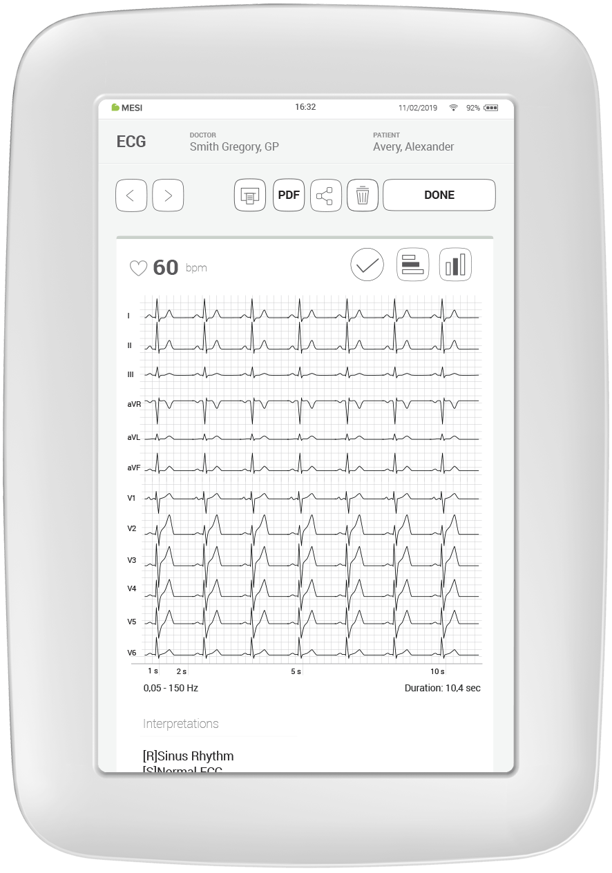 12-Lead Resting ECG