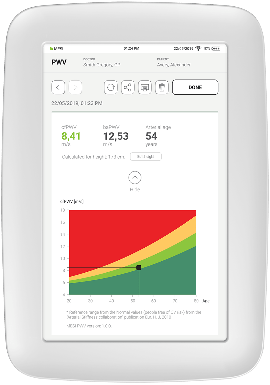 Pulse Wave Velocity