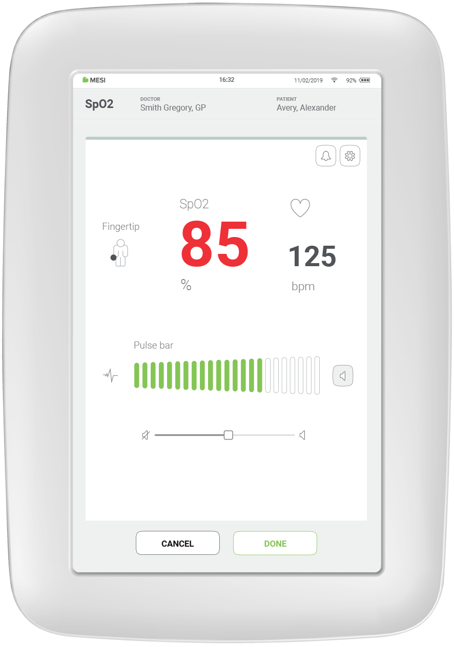 Pulse Oximetry